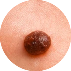 Close-up of a mole